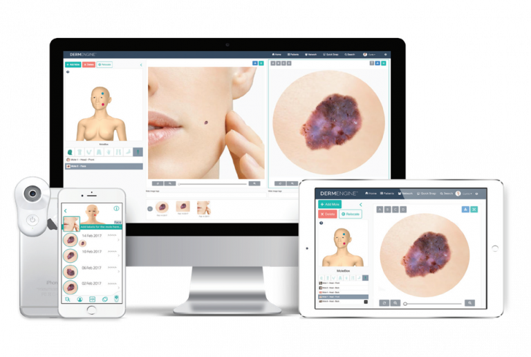 2/2021: CliniWorks and MetaOptima Canada alliance for a joint TeleDermatology solution global delivery and 2021-2023 advanced AI R&D program
